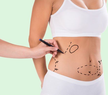 non-surgical-liposuction